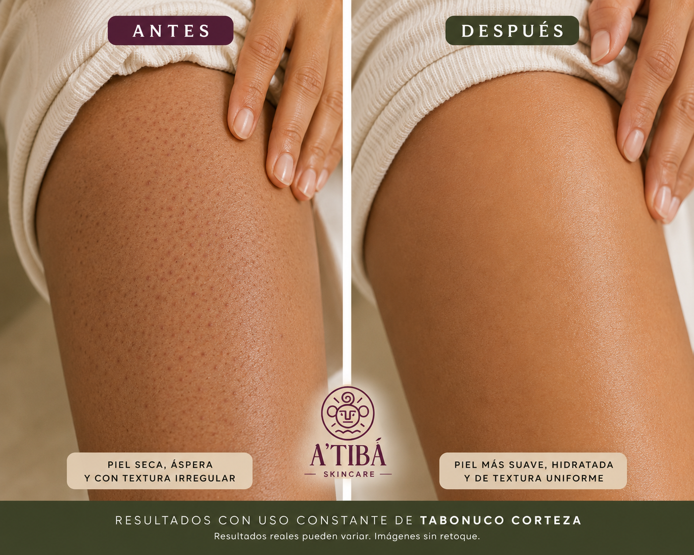 TABONUCO™ CORTEZA — Crema Corporal Avanzada / Advanced Body Cream